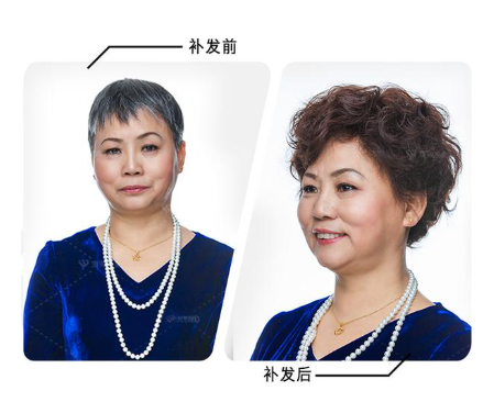 案例
